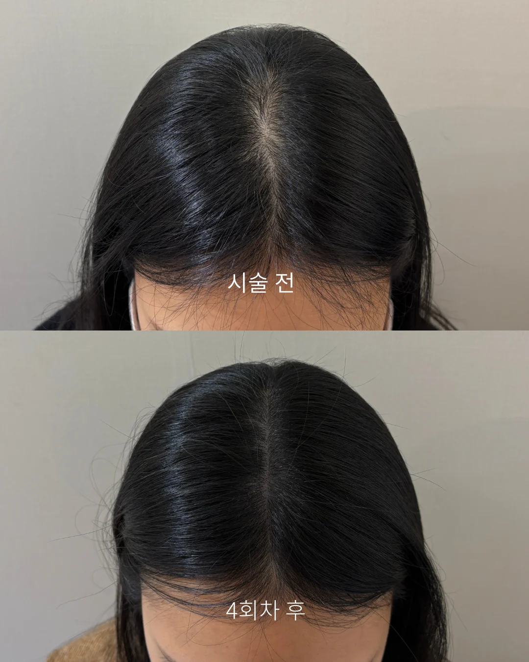 실제 고객 변화 사례 3