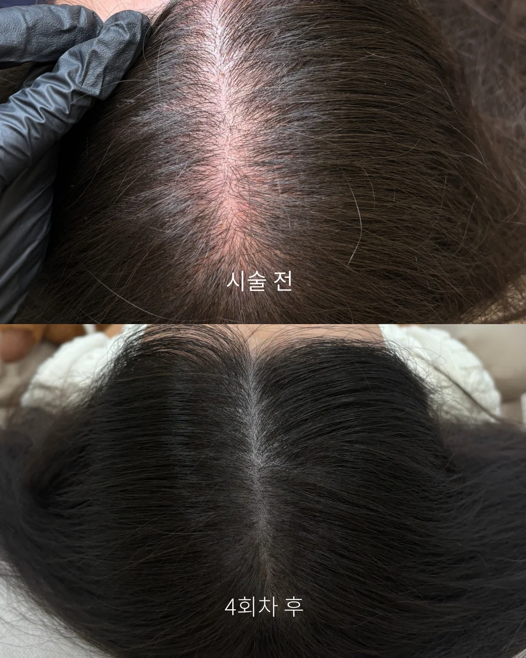 실제 고객 변화 사례 4