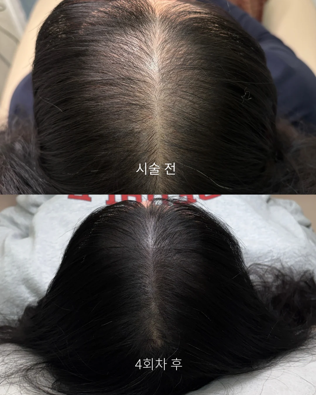실제 고객 변화 사례 5